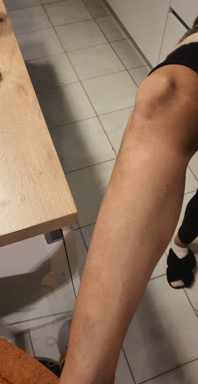 Dopo del percorso di benessere raccontato da Angelucci Nora